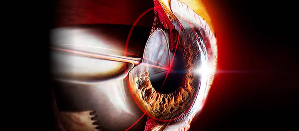 eye2